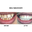 Dental Perfection Coventry